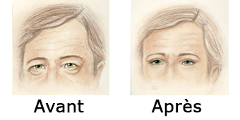 Comparaison