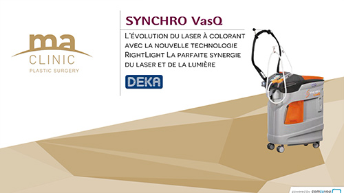 Synchro vasq, la nouvelle génération de lasers