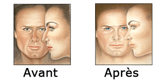 Comparaison