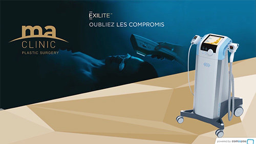 Exilite, oubliez les compromis