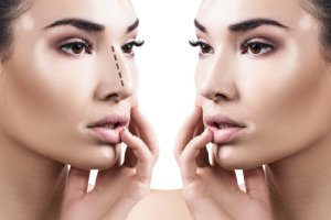 The appearance of the nose, essential element of the face can be corrected in some cases. The medical team of MaClinic's facial surgery practice in Brussels explains the circumstances under which rhinoplasty can be considered.